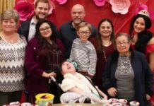 ২০তম জন্মদিন পালন করলেন মস্তিষ্ক ছাড়া জন্ম নেওয়া অ্যালেক্স